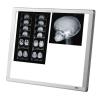 Ngatoscope LED extra-plat 2 plages - Reconditionn