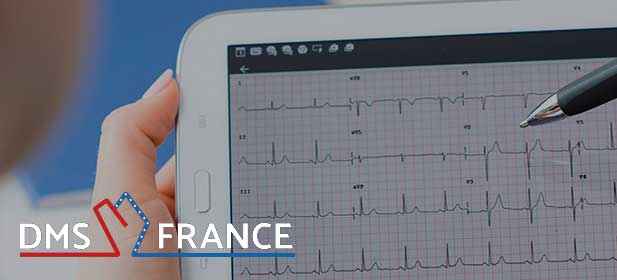 Holter ECG DMS