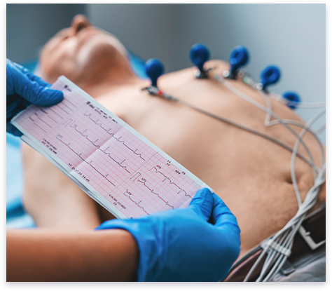 Enregistrement d'un ECG