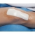 Pansements adh�sifs st�riles Tegaderm + Pad 3M
