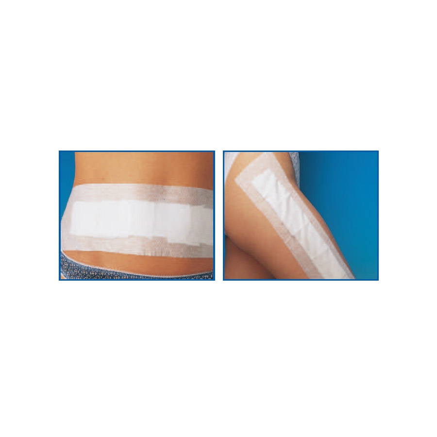 Urgo Urgoderm Sparadrap Non Tissé Extensible 5mX10cm