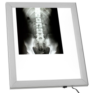 Ngatoscope AF300 LED extra-plat 1 plage - format A3