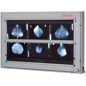 Négatoscopes de mammographie SEN\'X