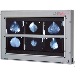 Ngatoscopes de mammographie SEN\'X