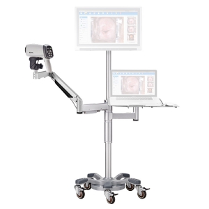 Colposcope Edan C6A HD avec chariot de transport
