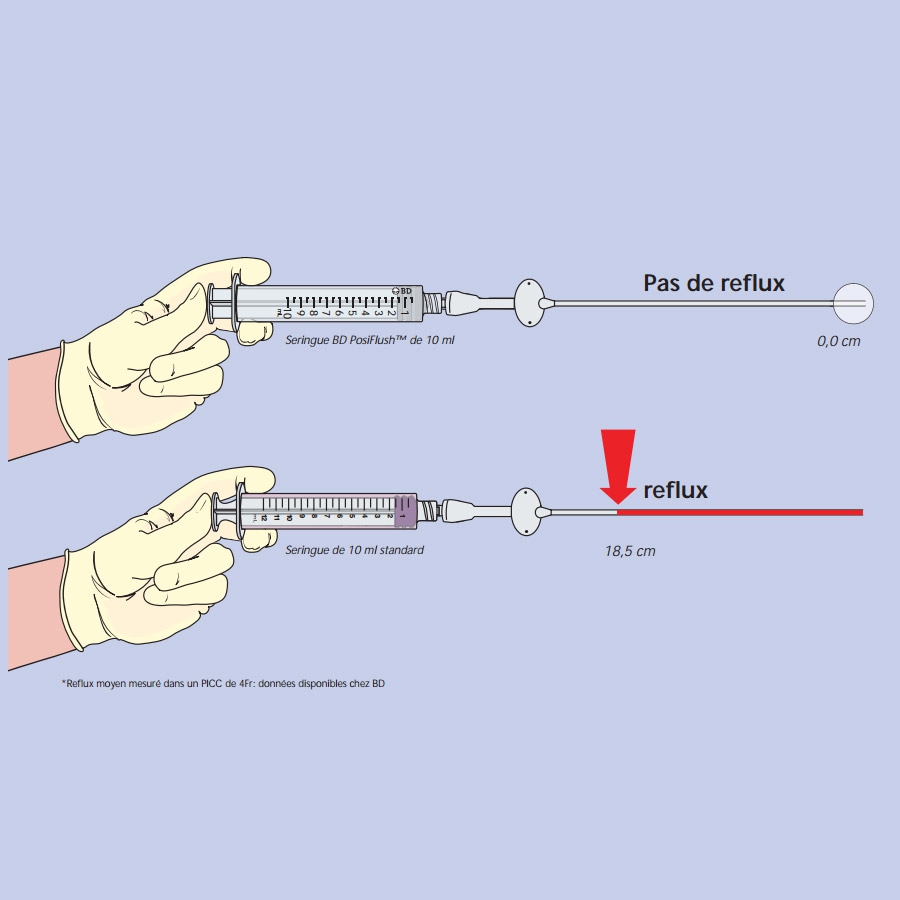 Seringue Posiflush pré remplie 10 ml