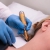 Cartouche de rechange pour Cryo IQ Derm