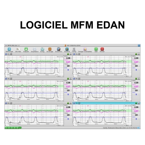 Logiciel MFM pour cardiotocographe EDAN F3