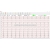 Electrocardiographe Cardiomate PC-ECG Bluetooth Spengler - Reconditionn�
