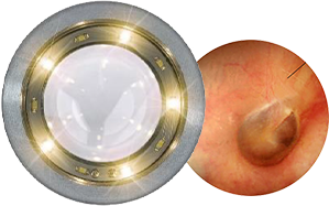 Otoscope CCT lumi�re blanche chaude