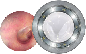 Otoscope CCT lumi�re blanche froide