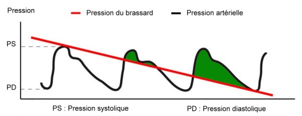 Comment utiliser un tensiomètre